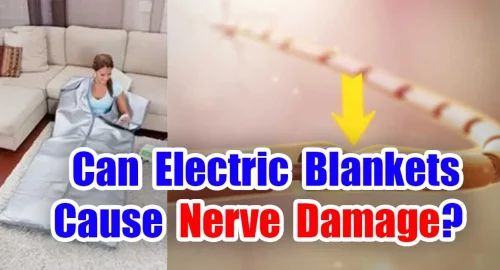 Can electric blankets cause nerve damage